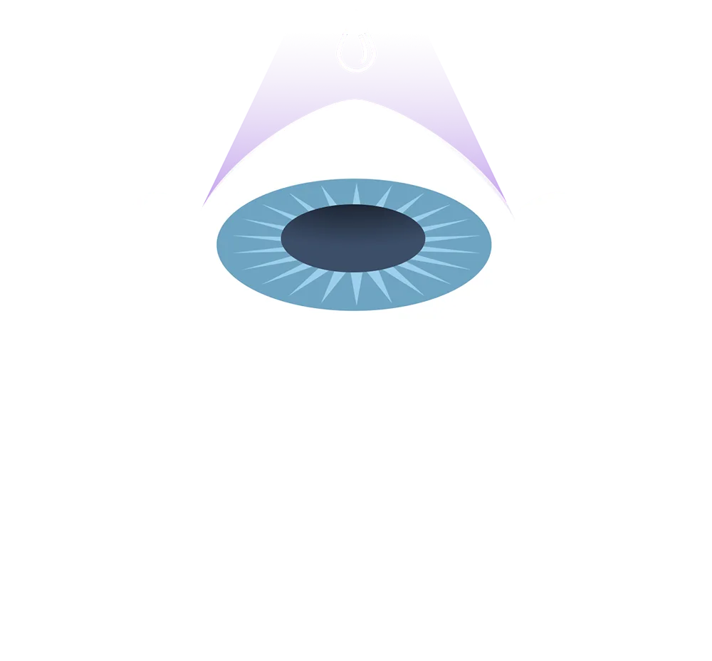 vzx-mc-s03-keratoconus