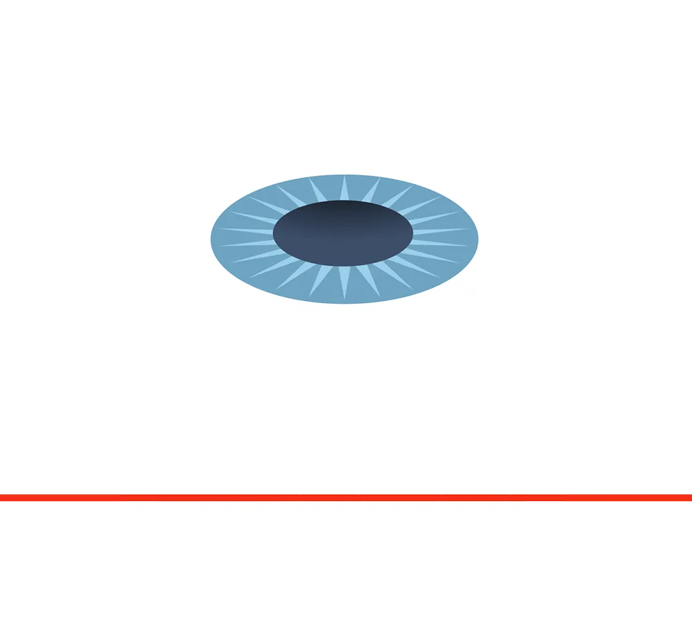 vzx-mc-s04-retina